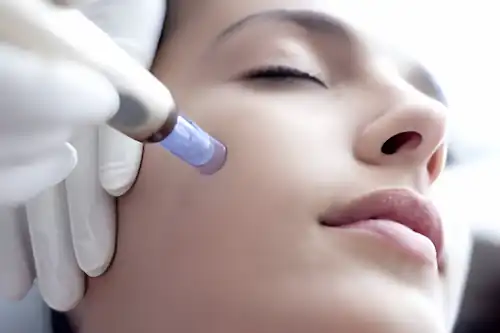 Microneedling treatment that boosts collagen for smoother and firmer skin at MedicineFourU